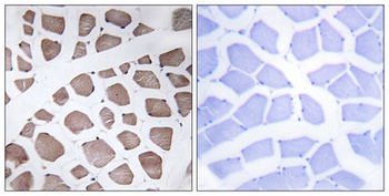 MRP-S18C antibody