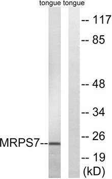 MRP-S7 antibody