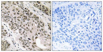 TNNI3K antibody