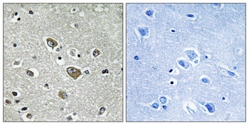 DHHC-9 antibody