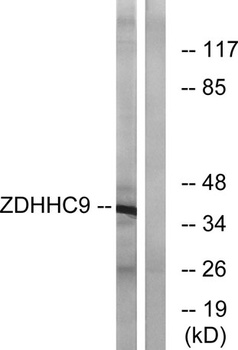 DHHC-9 rabbit pAb