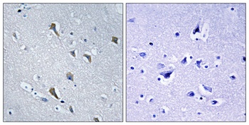 MRP-S2 rabbit pAb