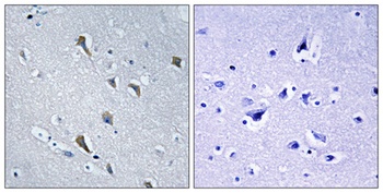 MRP-S2 antibody