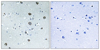 MATCH2 antibody