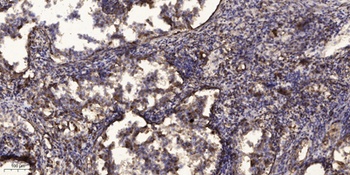 PIPOX antibody