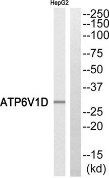 V-ATPase D rabbit pAb