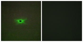 AMPK gamma 2 antibody