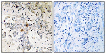pNO40 rabbit pAb Antibody