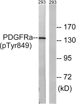 PDGFR-alpha (phospho-Tyr849) antibody