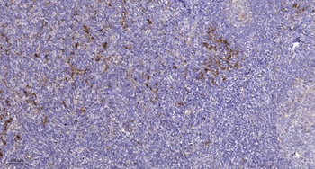 PDGFR-α (phospho Tyr849) rabbit pAb