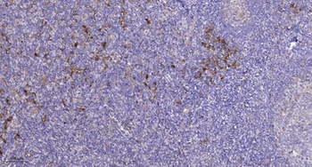 PDGFR-alpha (phospho-Tyr849) antibody