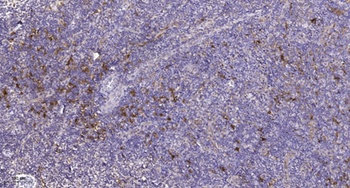 PDGFR-α (phospho Tyr762) rabbit pAb