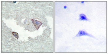 PDGFR-α (phospho Tyr754) rabbit pAb
