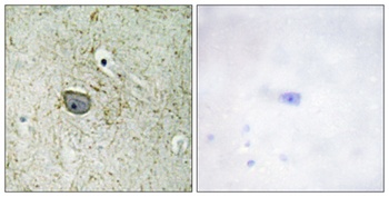 PDGFR-α rabbit pAb