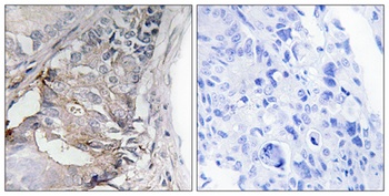 PDGFR-beta (phospho-Tyr740) antibody