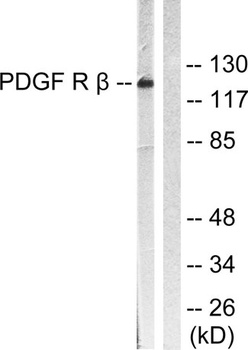 PDGFR-β rabbit pAb