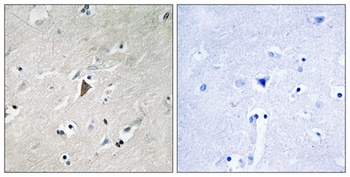 PDHK1 (phospho Tyr9) rabbit pAb