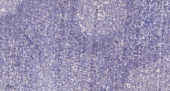 PDHK1 rabbit pAb