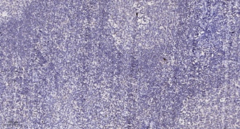 PDK1 antibody