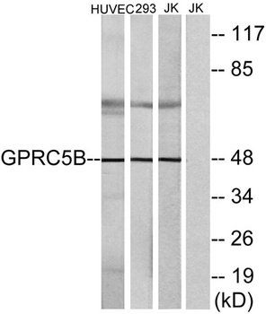 GPRC5B rabbit pAb