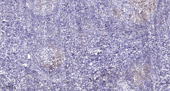CD31 (phospho-Tyr713) antibody