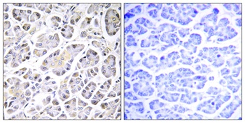 ATP5G3 rabbit pAb