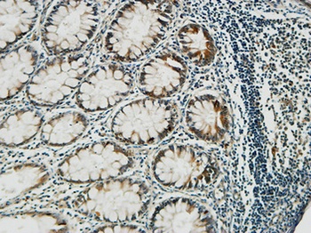 PGD rabbit pAb