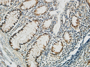 PGD rabbit pAb