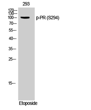 PR (phospho Ser294) rabbit pAb