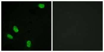 PR (phospho Ser294) rabbit pAb