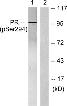 PR (phospho Ser294) rabbit pAb