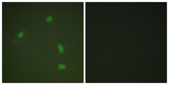PR (phospho-Ser400) antibody