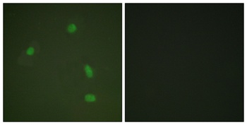 PR (phospho Ser400) rabbit pAb