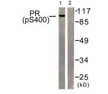 PR (phospho-Ser400) antibody