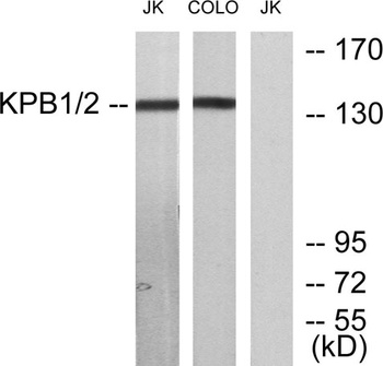 PHKA1/2 rabbit pAb
