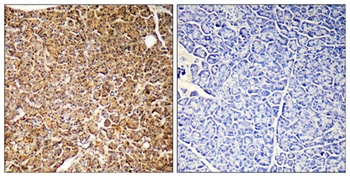 PI 3-Kinase p110γ rabbit pAb