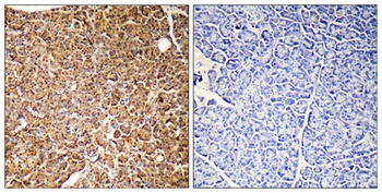 PI 3-Kinase p110 gamma antibody