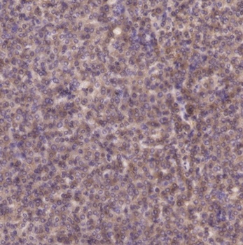 PI 3-kinase p85β (phospho Tyr464) rabbit pAb