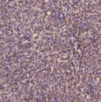 PI 3-kinase p85 beta (phospho-Tyr464) antibody