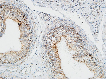 Pin1 antibody