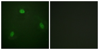 Pin1 antibody