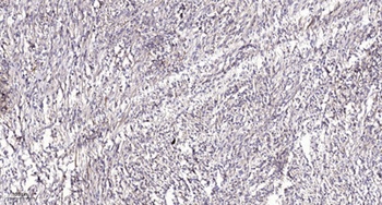 PKD2 (phospho Ser812) rabbit pAb