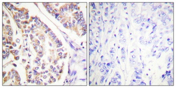 cPLA2 (phospho-Ser505) antibody