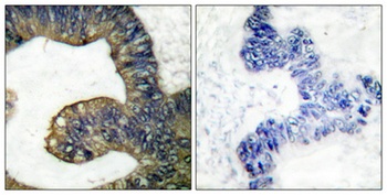 cPLA2 antibody