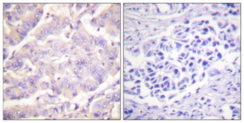 cPLA2 antibody