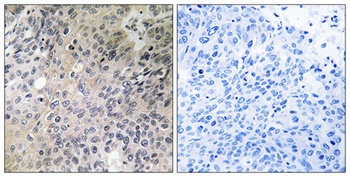 N-Shc rabbit pAb Antibody