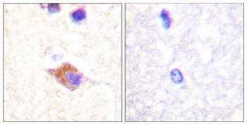 PLC gamma 2 (phospho-Tyr1217) antibody