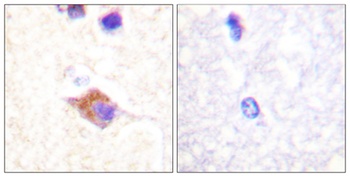 PLC γ2 (phospho Tyr1217) rabbit pAb