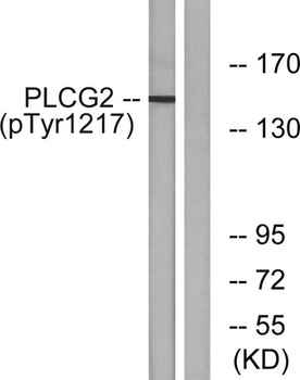 PLC γ2 (phospho Tyr1217) rabbit pAb