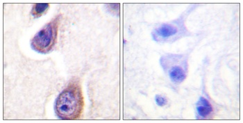 PC-PLD1 (phospho-Ser561) antibody